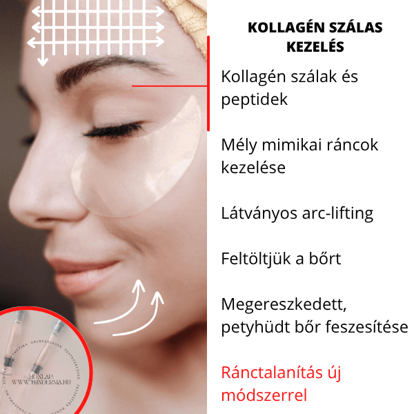 Kollagén kezelés