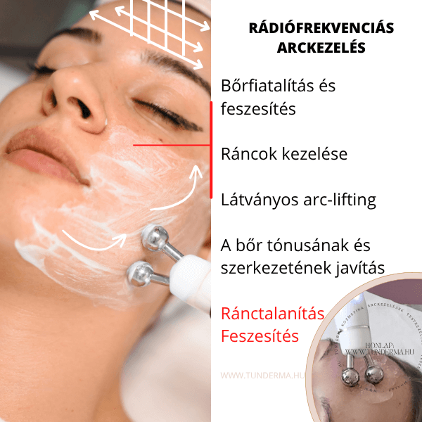 Rádiórekvenciás arckezelés