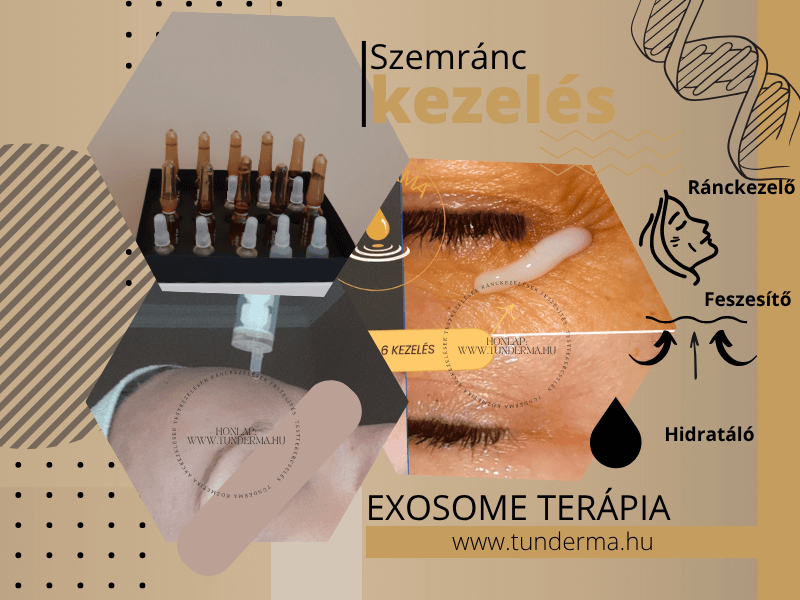 szemránc kezelés