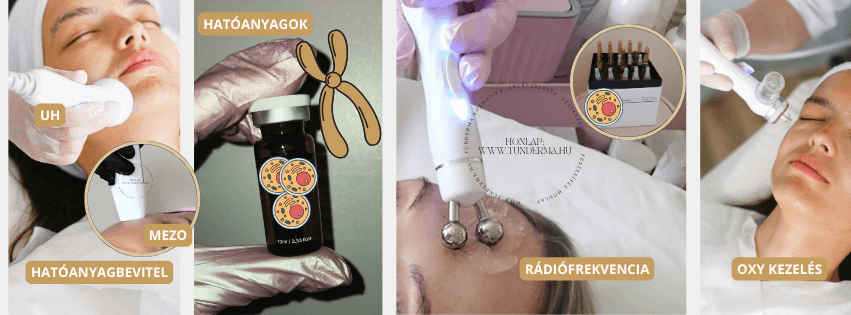 Pigmentfoltok kezelése
