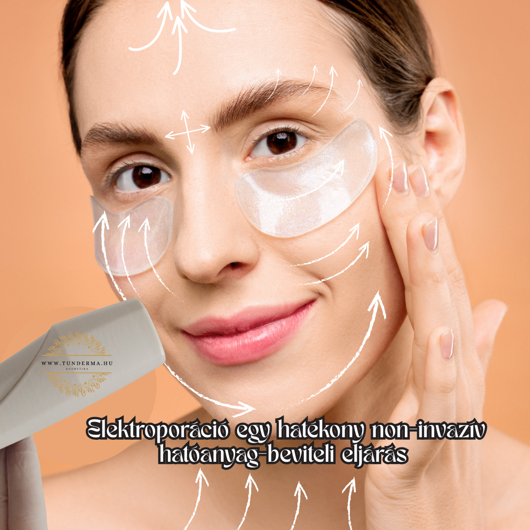 Mátrixpontos rádiófrekvencia (RF) Thermage