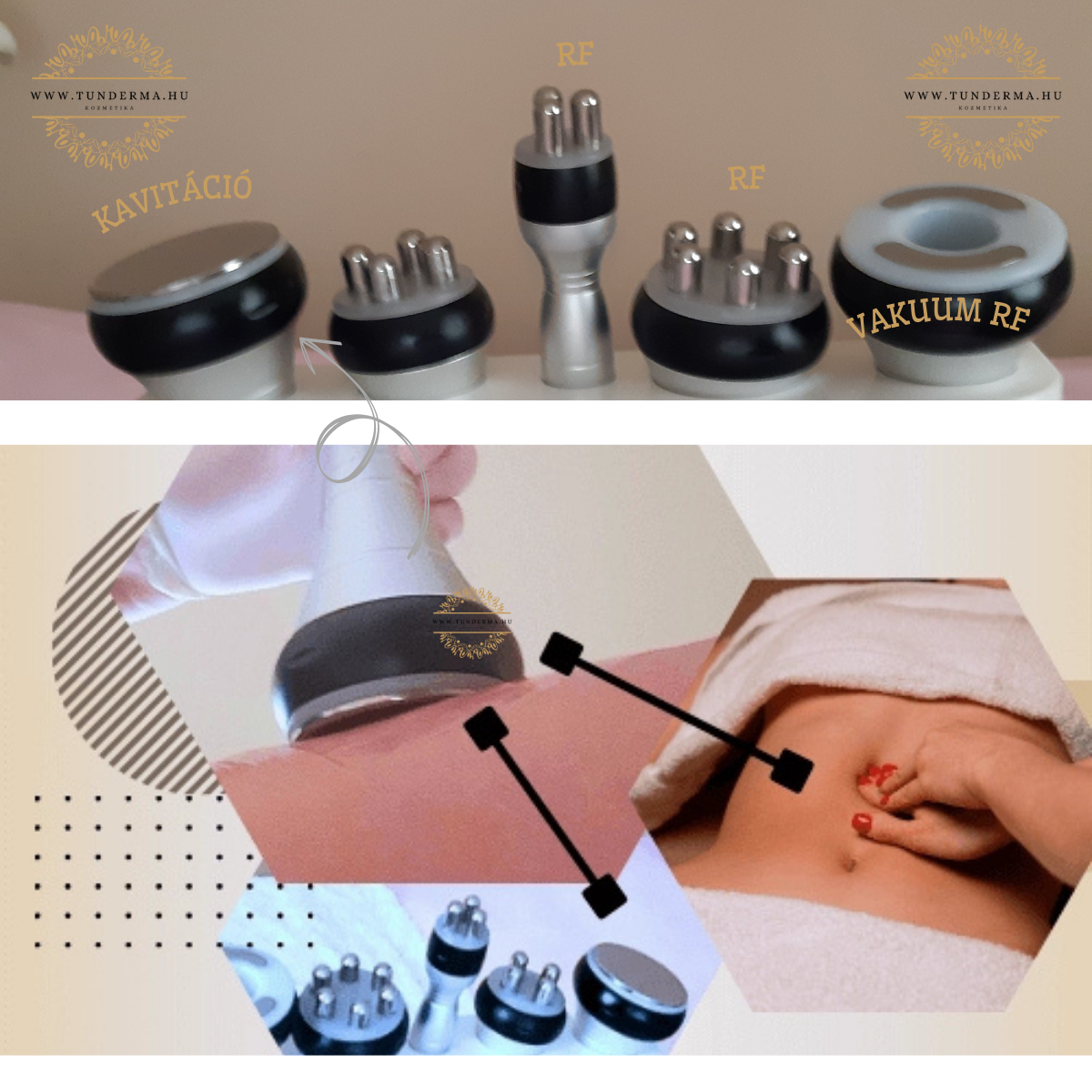 Kavitációs zsírbontás veszélyei