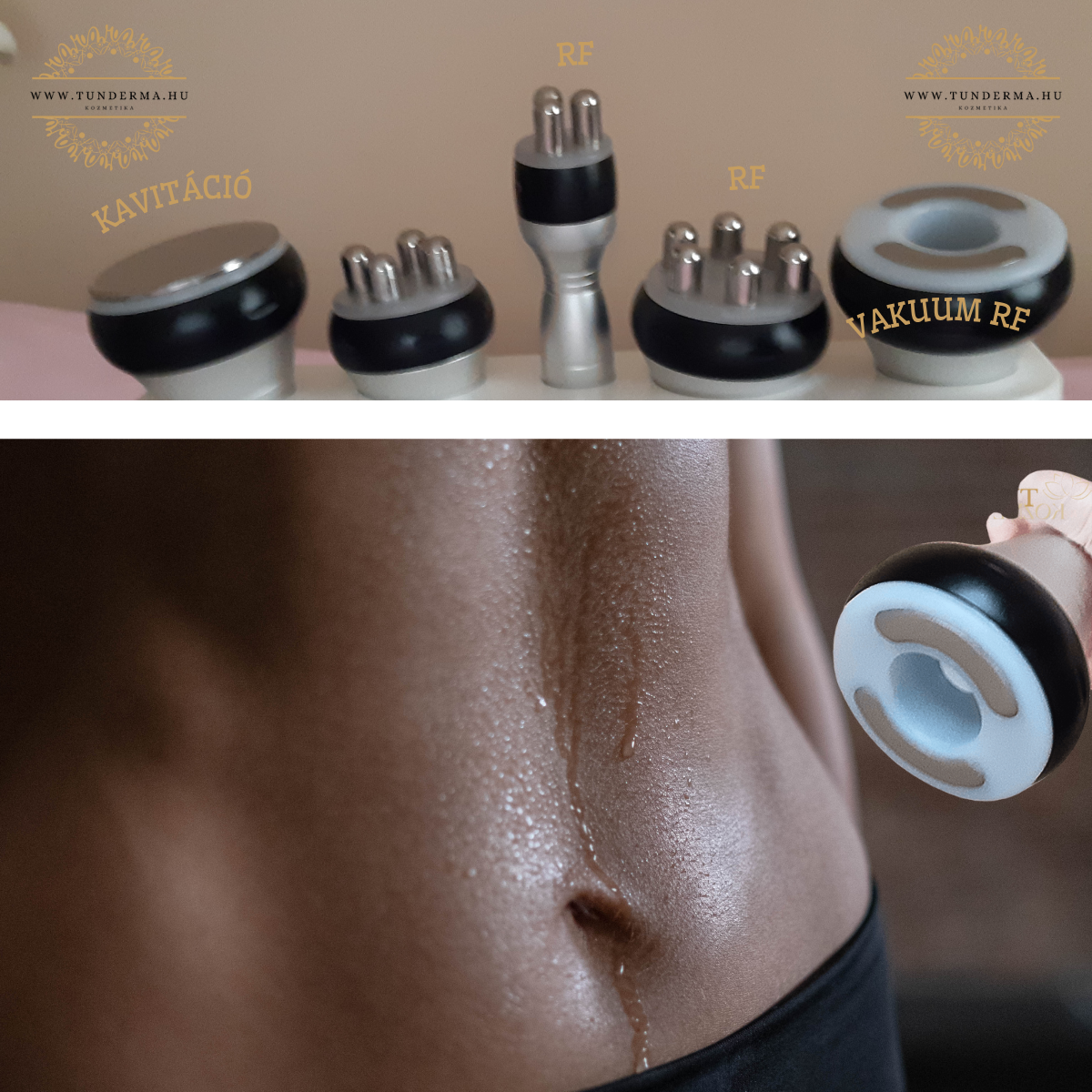 Kavitációs zsírbontás vélemények