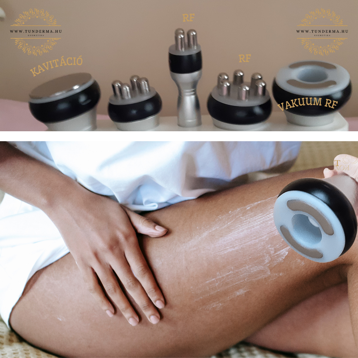Vákuumos rádiófrekvenciás testkezelés