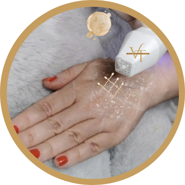 Mátrixpontos RF kezelés