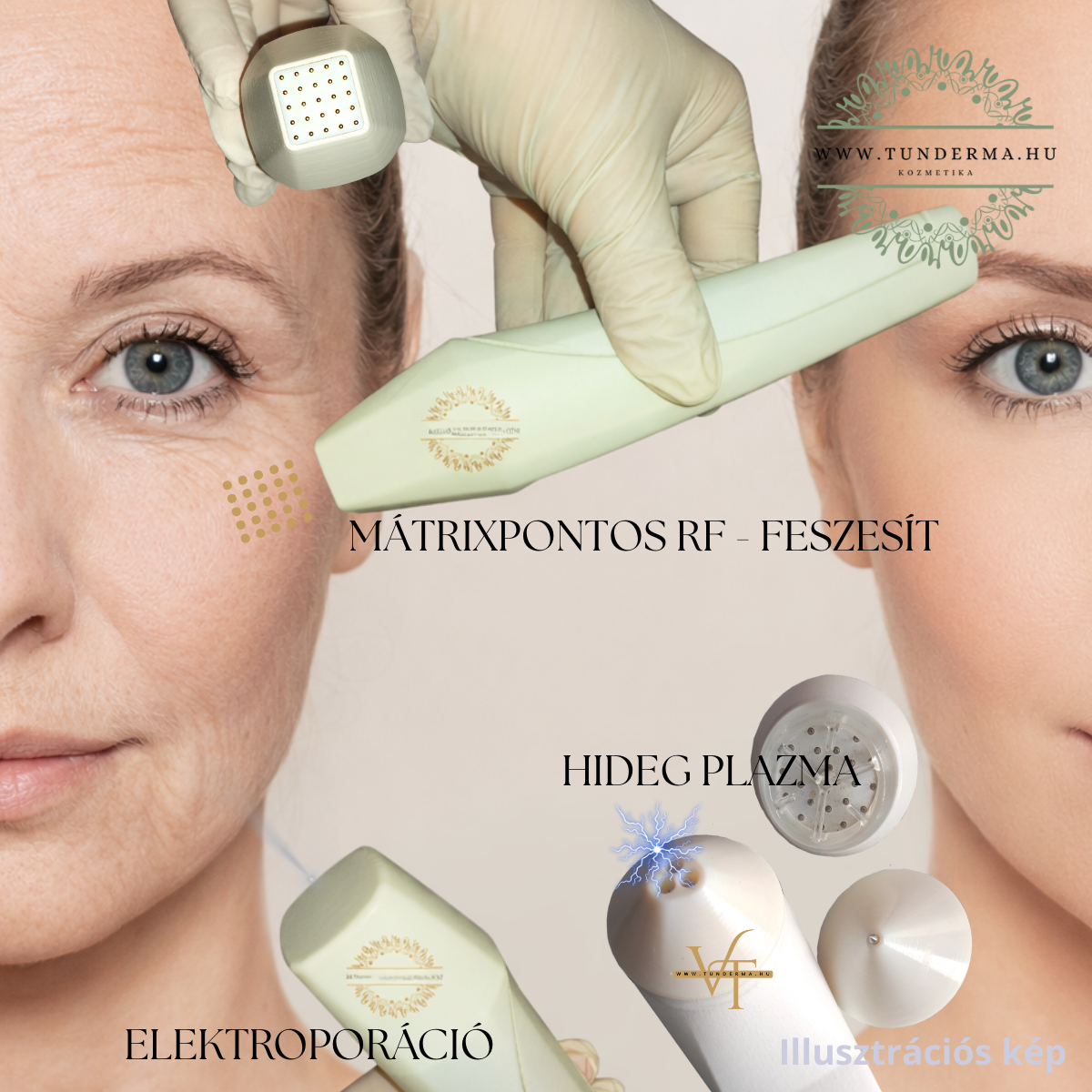 Anti-ageing arckezelés