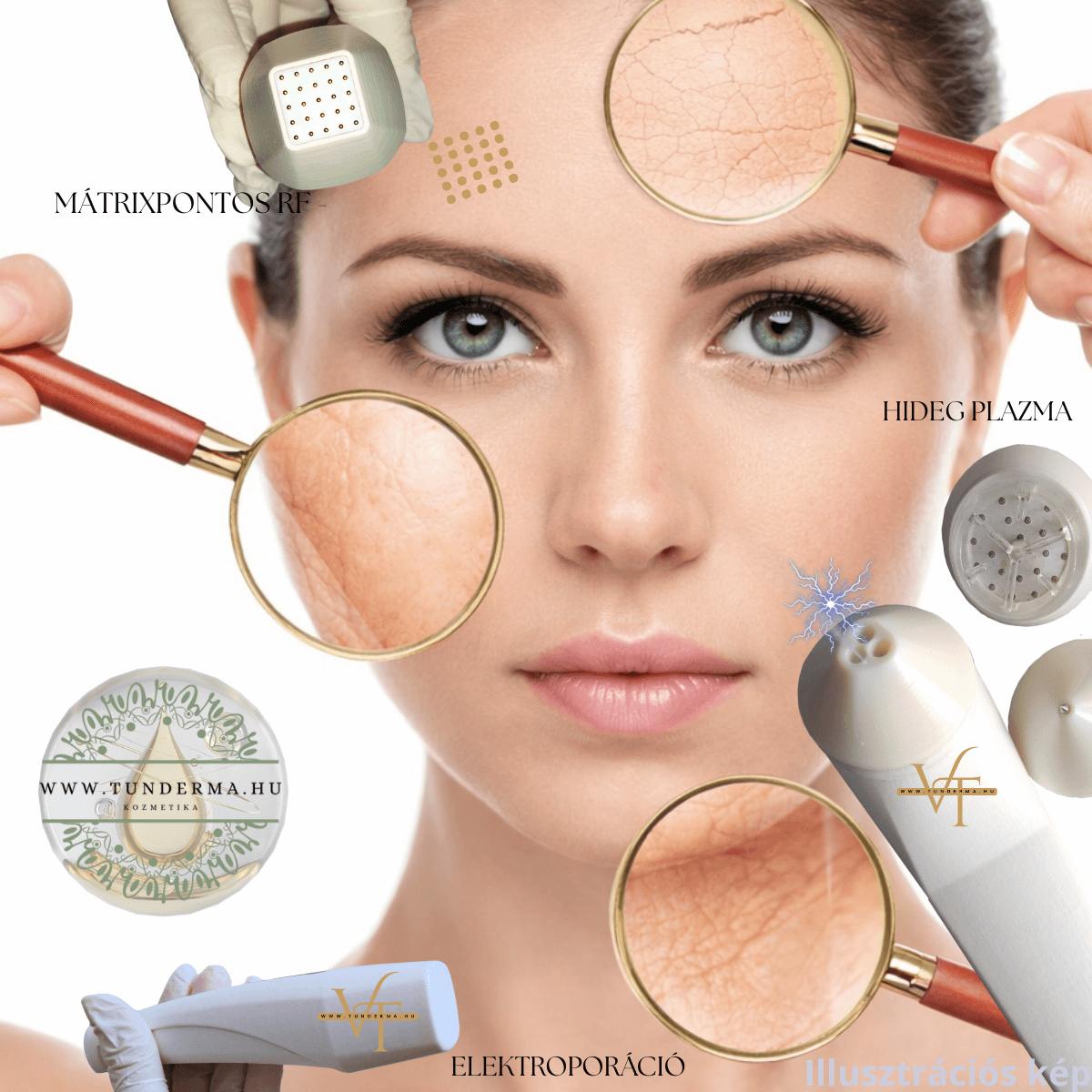 Kollagén Indukciós Kezelés