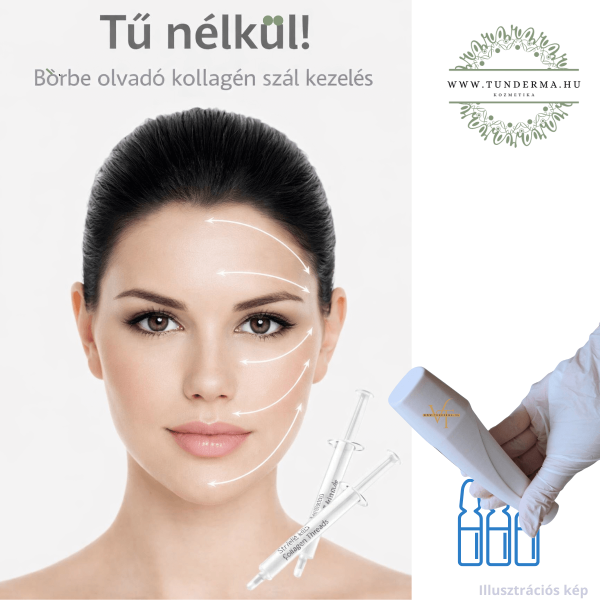 Kollagén szál terápia