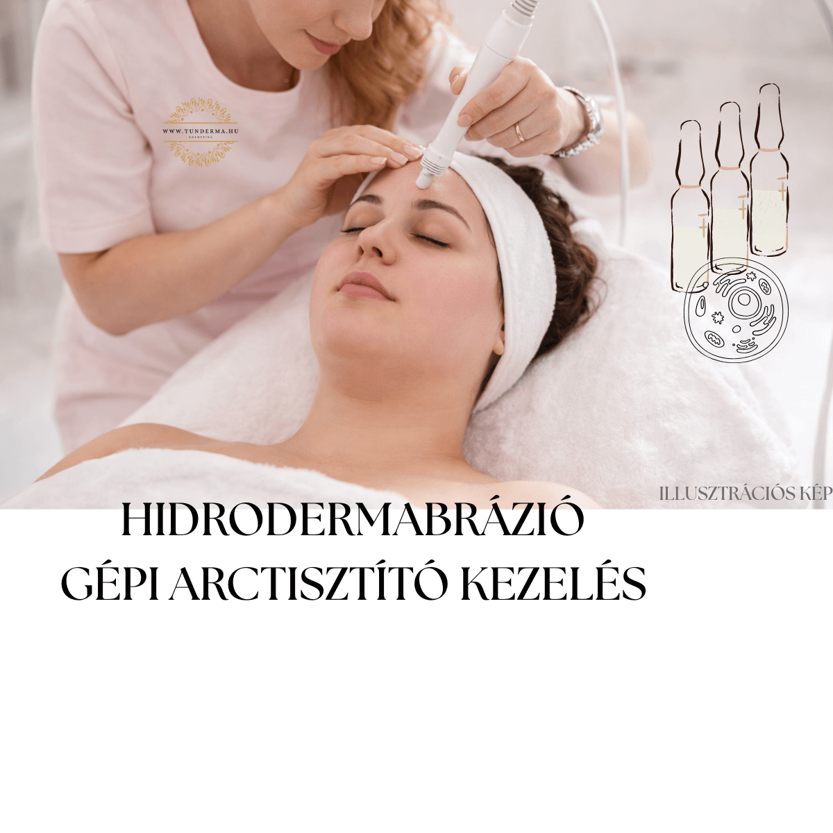 Illusztációs kép: hidrodermabrázió