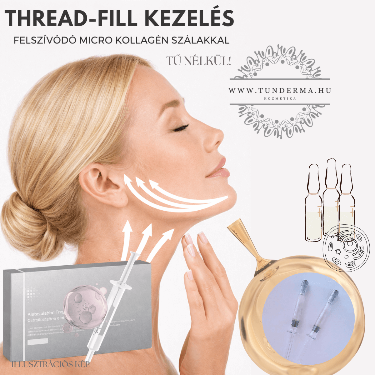 THREAD-FILL KEZELÉS AIILLUSZTRÁCIÓSKÉP