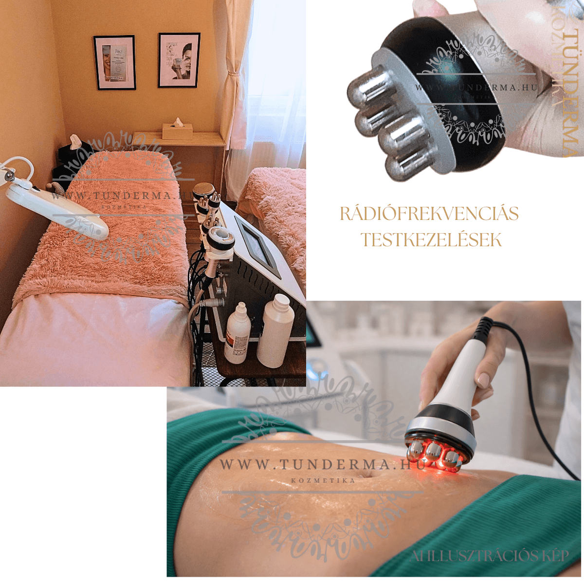 RÁDIÓFREKVENCIÁS TESTKEZELÉS