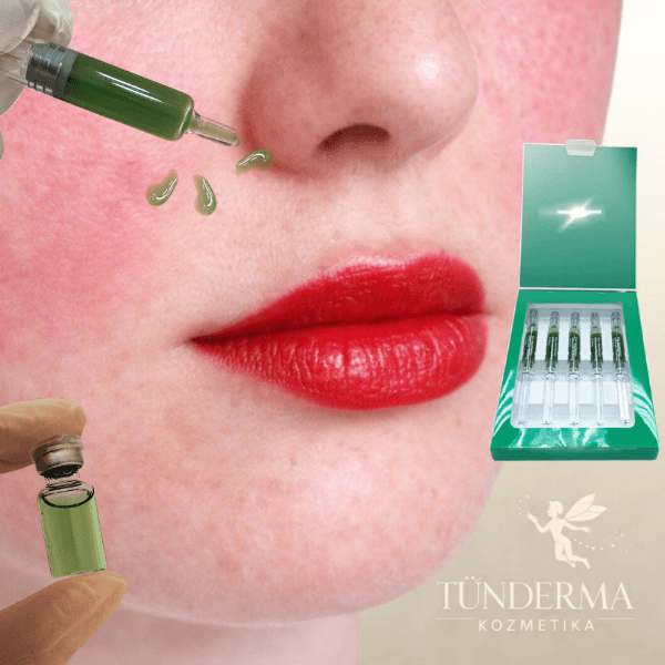 ROSACEA KEZDŐDIK? ÁPOLÁS AZ ÉRZÉKENY, KIPIROSODÁSRA HAJLAMOS BŐRRE