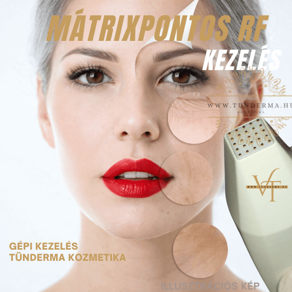 Mátrix RF GÉPI KEZELÉS